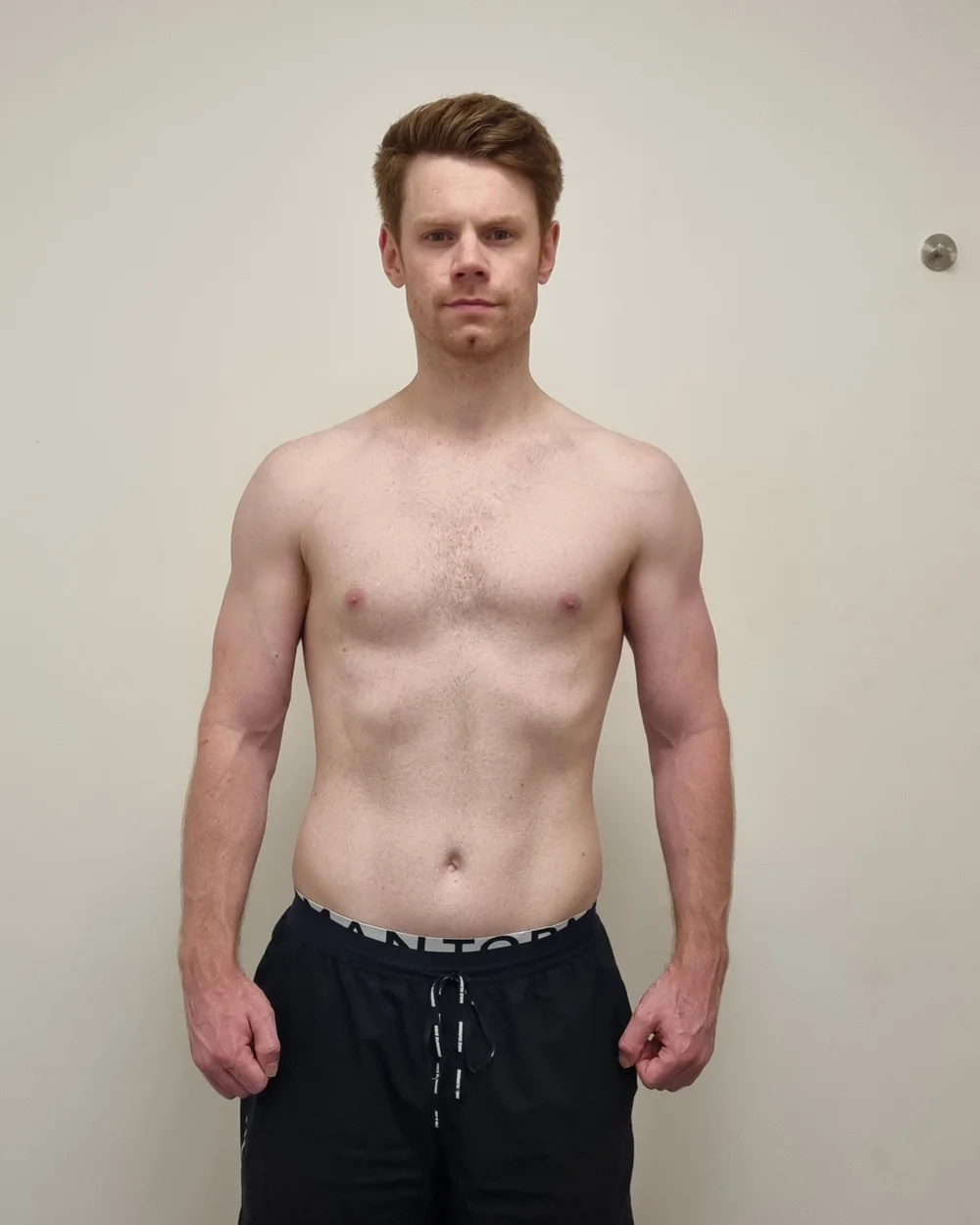 Client after photo