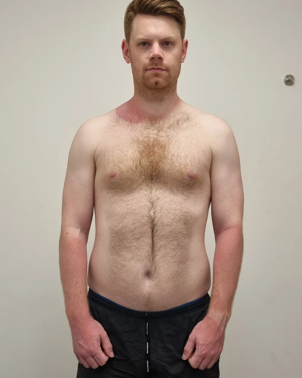 Client before photo