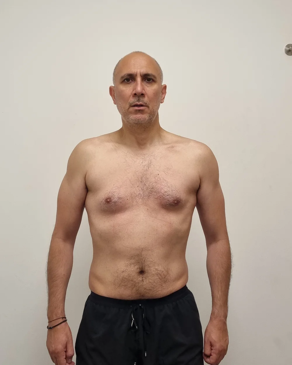 Client after photo