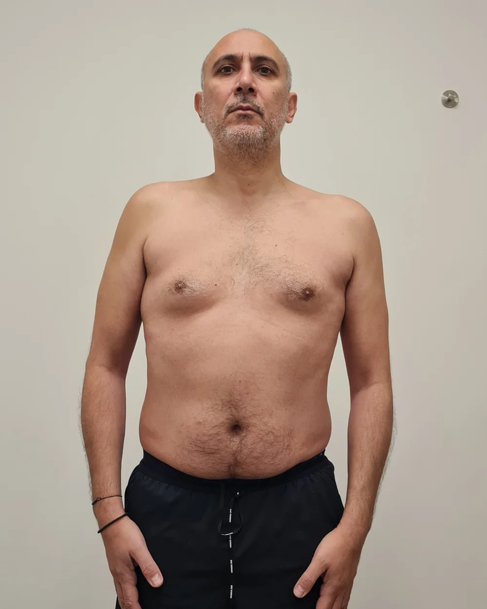 Client before photo