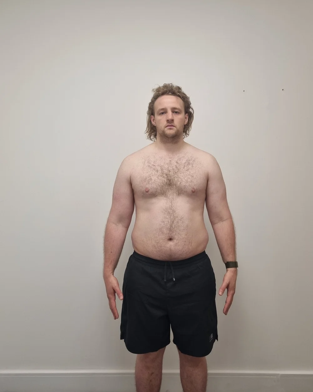 Client before photo