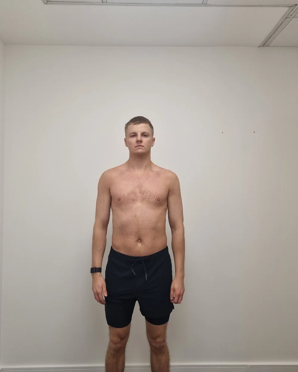 Client before photo