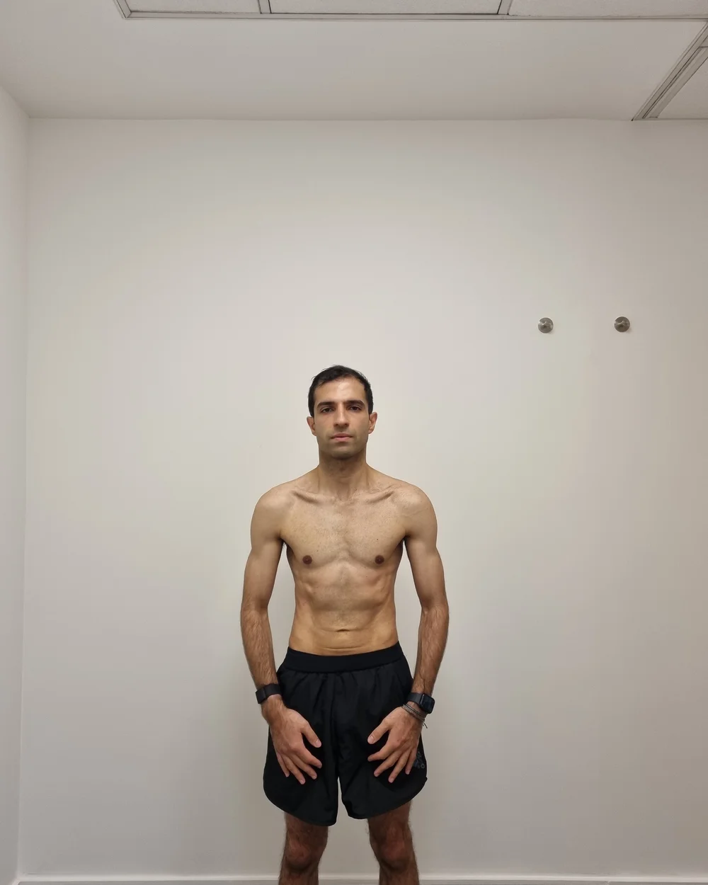 Client after photo