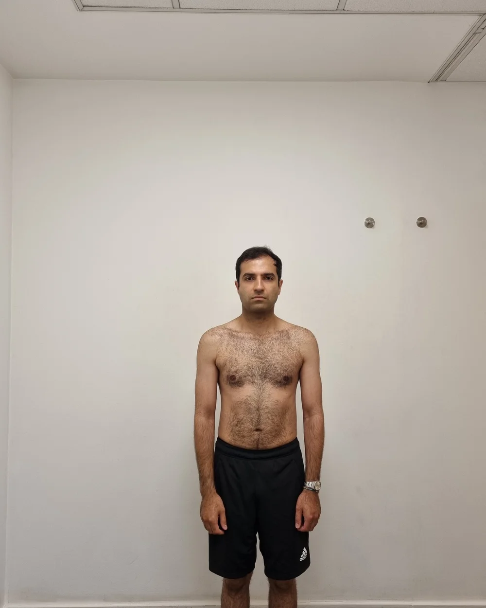 Client before photo