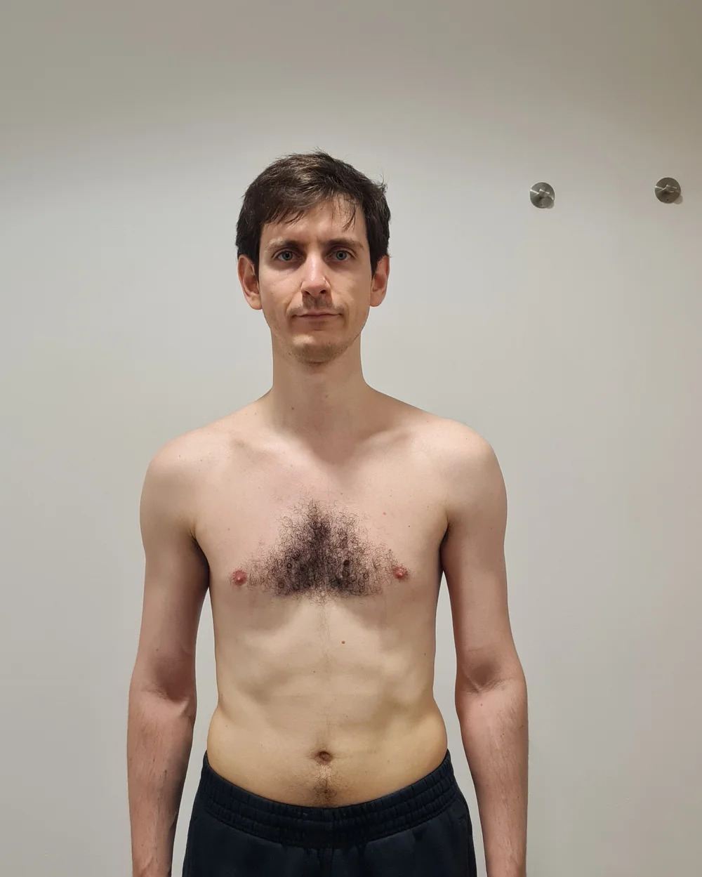 Client before photo