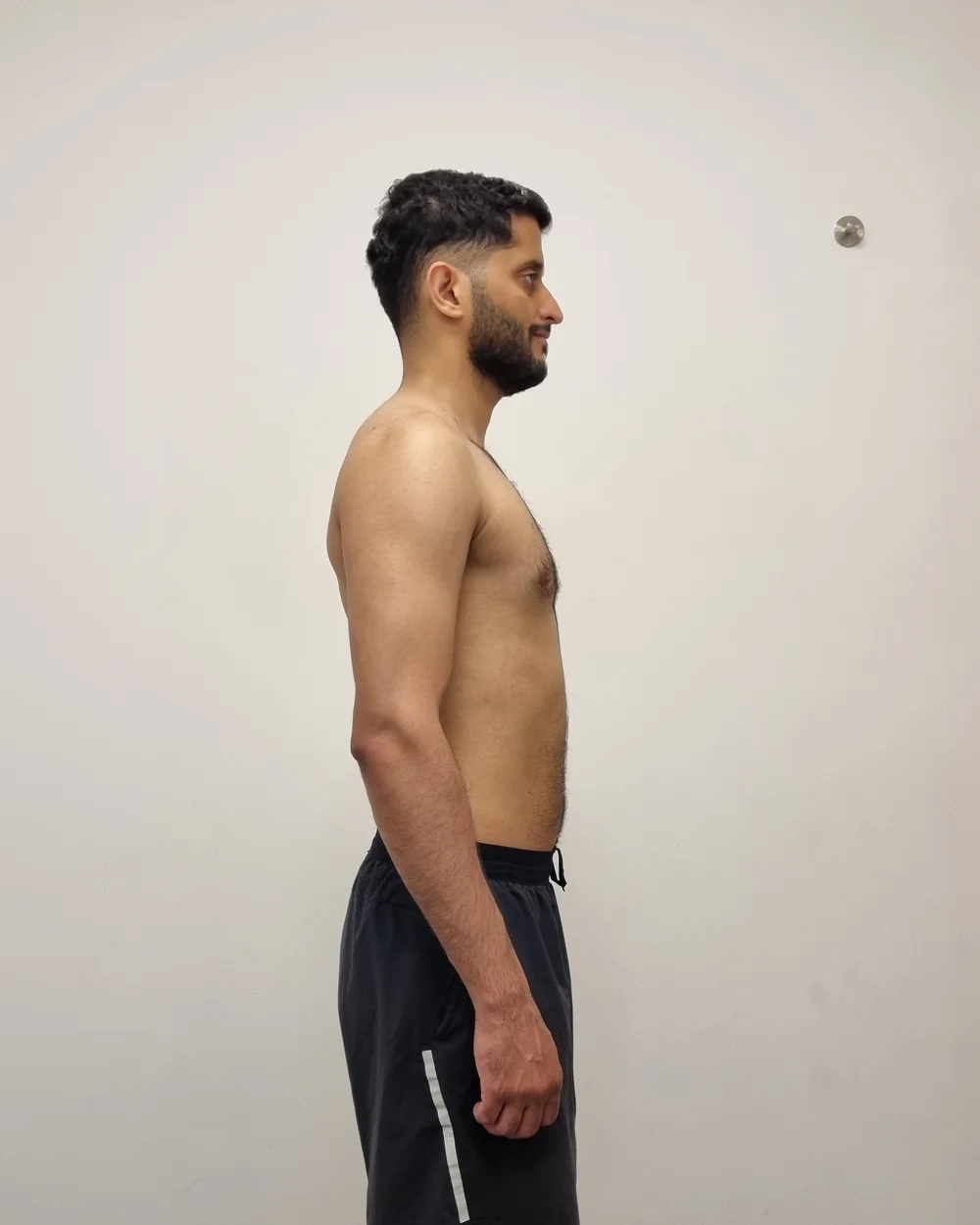 Client after photo
