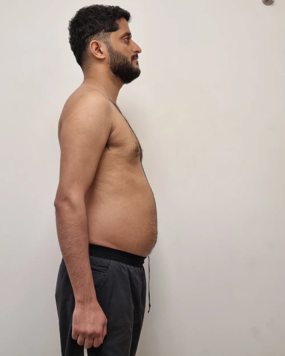 Client before photo