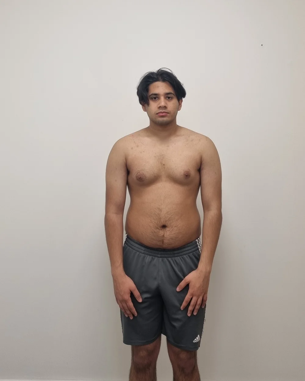 Client before photo