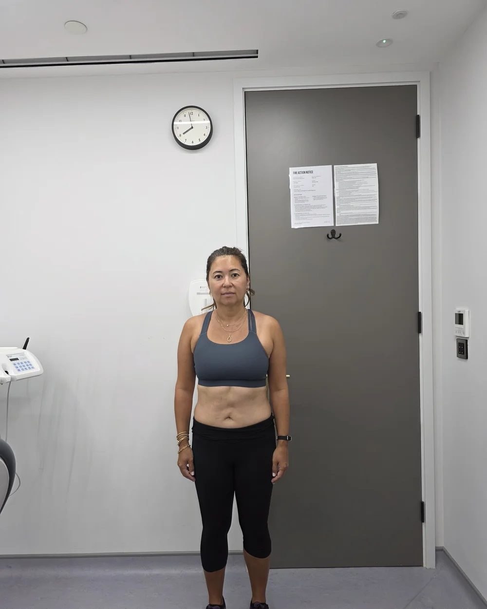 Client before photo